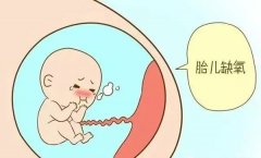 孕妇突发宫内窘迫胎儿危急 徐州妇幼保健院医护紧急救治母婴脱险