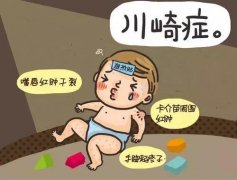 徐州市儿童医院心血管专家：川崎病最明显特征高烧不退、食欲不振