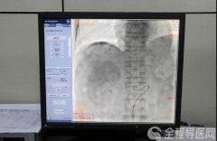 徐州介入科专家袁磊：错过外科手术时机，也要创造肿瘤治疗机会！